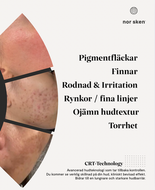 Facial cream nor sken® restore