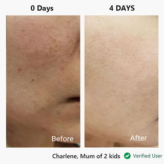 Facial cream nor sken® restore