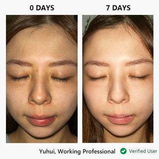 Facial cream nor sken® restore